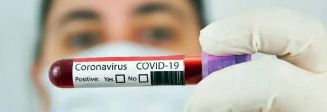 Tornano a salire i contagi: sono in tutto 307 i positivi al Covid-19