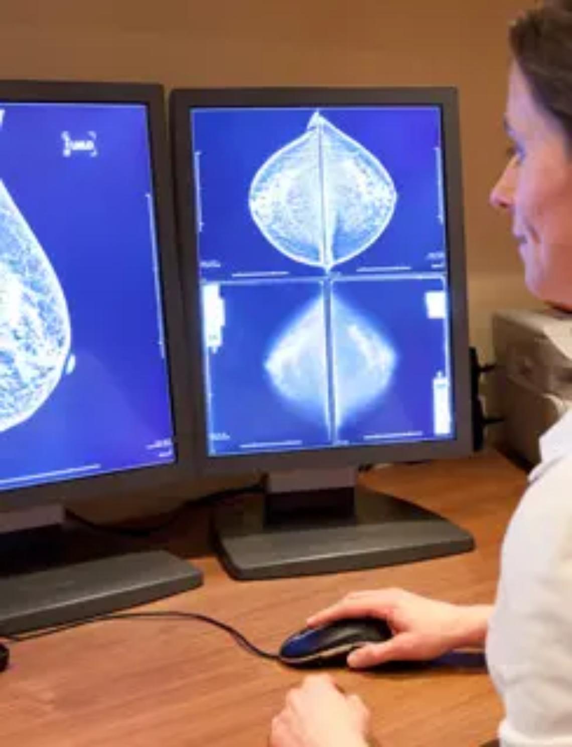 Screening oncologici: alti i livelli di adesione nella Asl Rm4