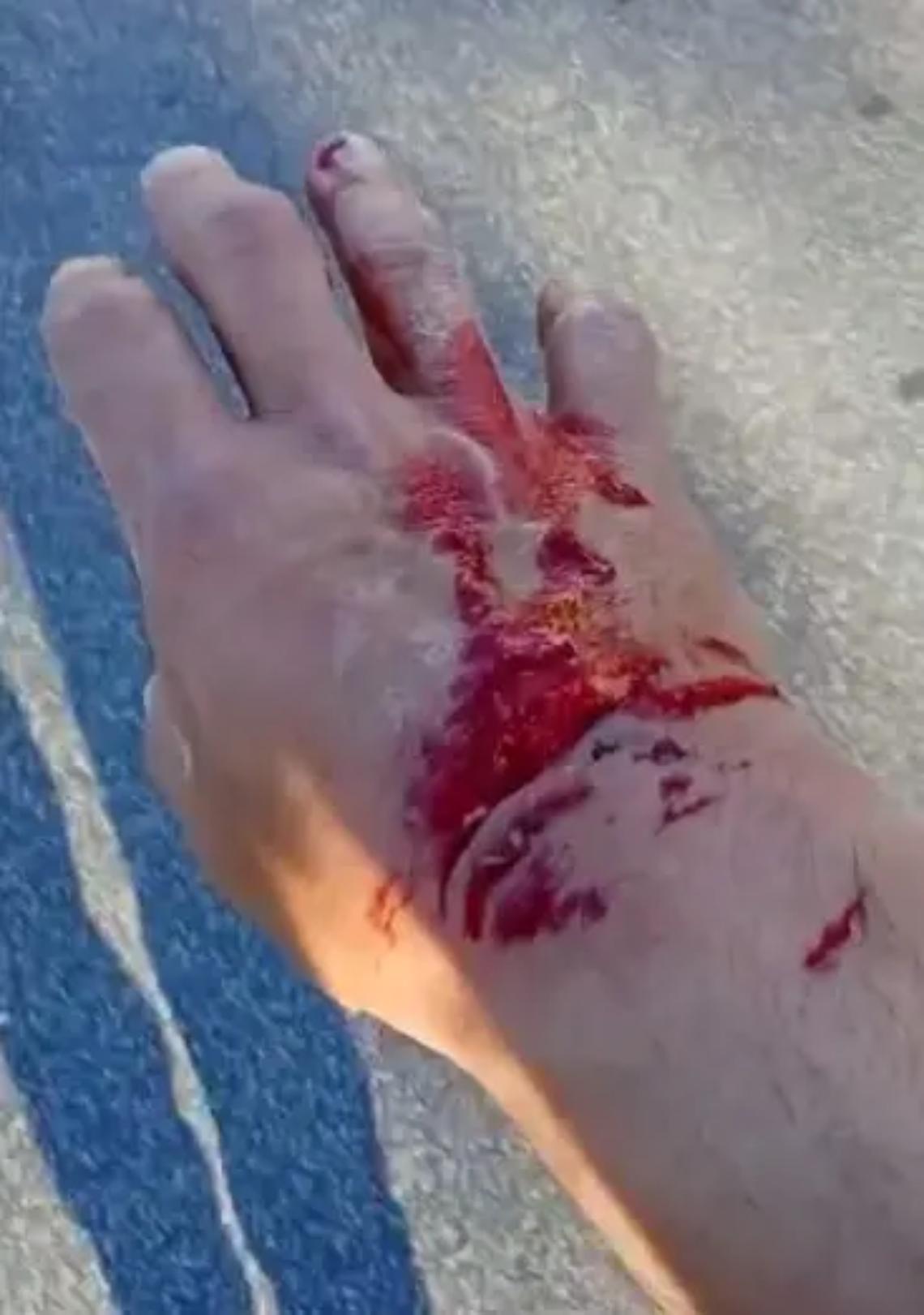 Cucciolo e padrone azzannati da un meticcio