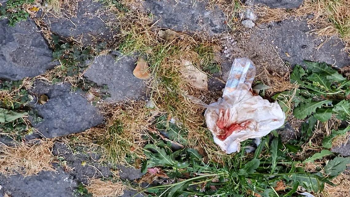 Accoltellato per difendere la fidanzata