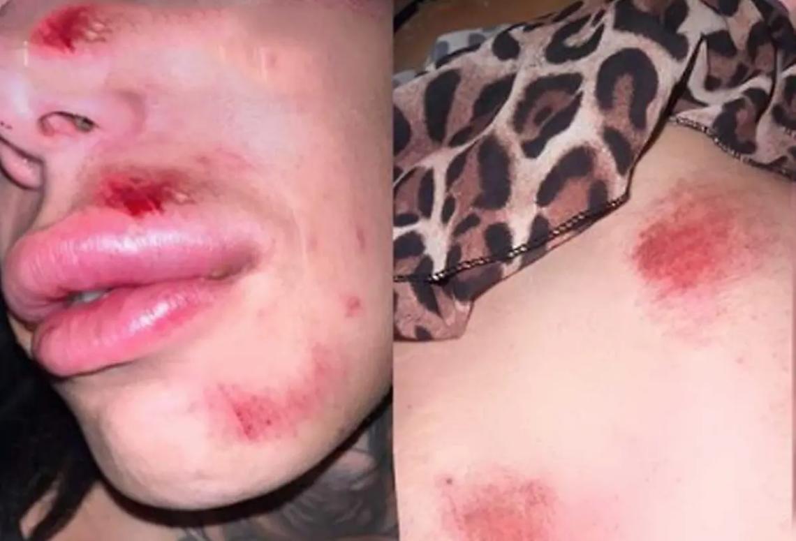 &laquo;Aggredite da un branco di ragazzi, nessuno &egrave; intervenuto e ha detto nulla&raquo;