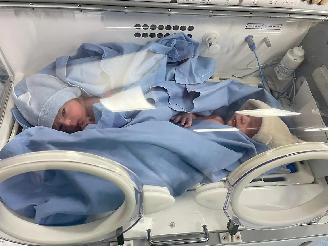 Parto gemellare alla 36^ settimana al San Paolo