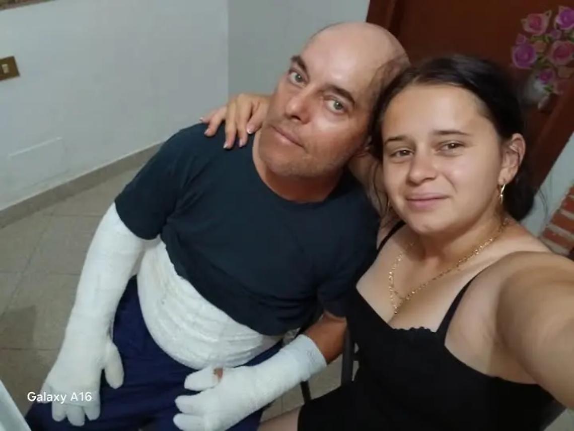 Sacripanti: &laquo;Mi &egrave; esplosa addosso una tanica di plastica piena di benzina lasciata nascosta&raquo;