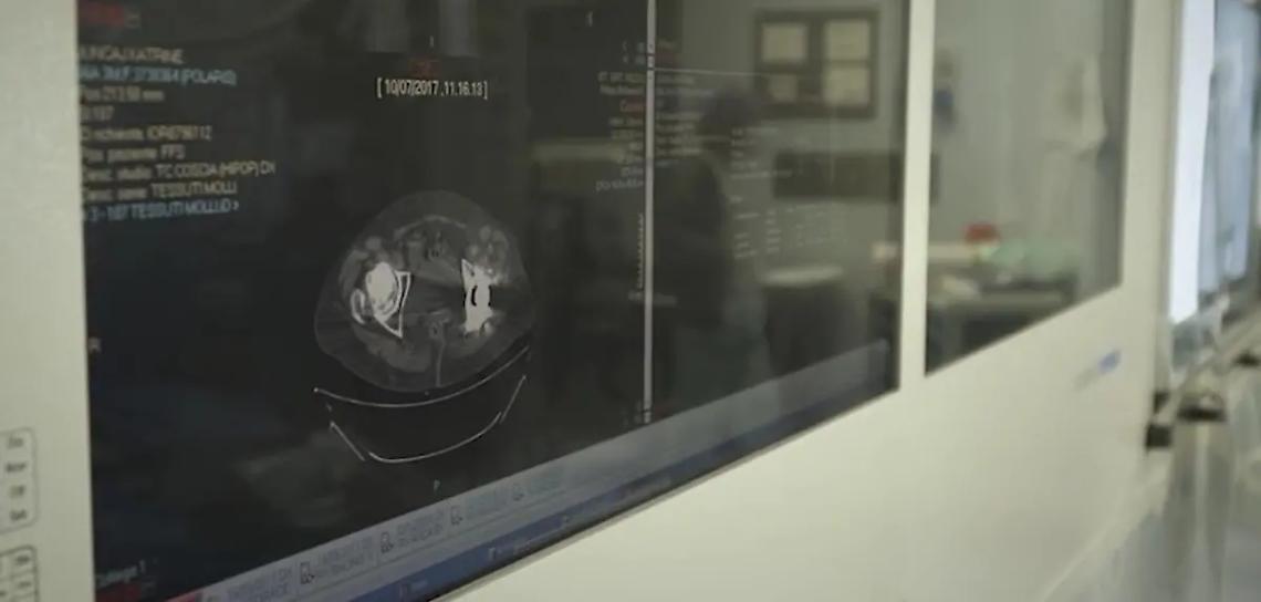 Tumore gastrico metastatico: verso un equo accesso alle cure su tutto il territorio nazionale