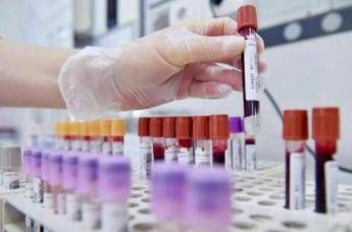 Allarme oncologi: "- 50% trial in Europa in 10 anni mentre Cina accelera"