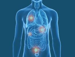 Cancro metastatico, la scienza avanza e iniziano grandi speranze